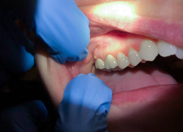 Best Emergency Treatment for Jaw Pain or Injury in Oakdale, PA